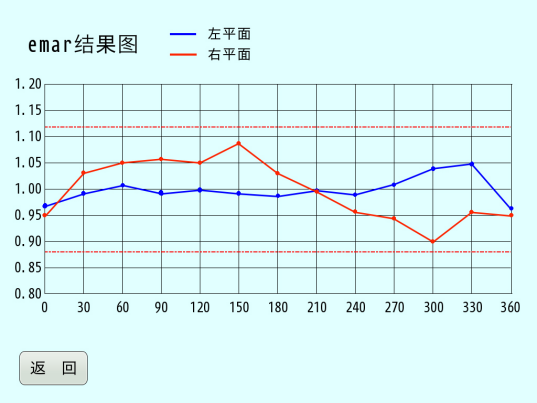 高精度平衡機